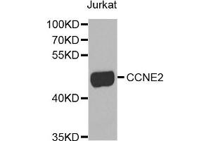 Western blot analysis of extracts of Jurkat cells, using CCNE2 antibody. (Cyclin E2 antibody)