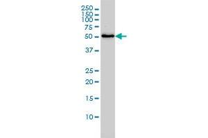 SARS monoclonal antibody (M01), clone 1H4 Western Blot analysis of SARS expression in Jurkat . (Seryl-tRNA Synthetase (SARS) (AA 1-514) antibody)