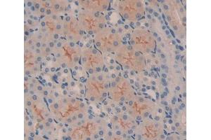 Used in DAB staining on fromalin fixed paraffin- embedded Kidney tissue (Metaxin 1 antibody  (AA 70-203))