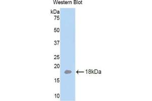 Western blot analysis of the recombinant protein. (LAMa4 antibody  (AA 102-234))