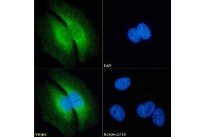 Immunofluorescence staining of fixed HeLa cells with anti-RAP antibody 7F1. (Recombinant LRPAP1 antibody)