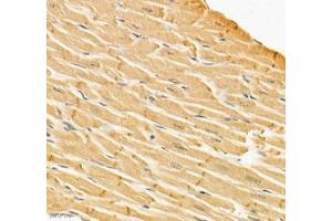Immunohistochemistry of paraffin embedded rat heart using Igfn1 (ABIN7074278) at dilution of 1:700 (400x lens) (IGFN1 antibody)