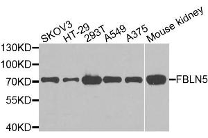 Western blot analysis of extracts of various cell lines, using FBLN5 antibody. (Fibulin 5 antibody)