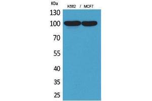 Western Blotting (WB) image for anti-Ectonucleotide pyrophosphatase/phosphodiesterase 3 (ENPP3) (Internal Region) antibody (ABIN3178304) (ENPP3 antibody  (Internal Region))