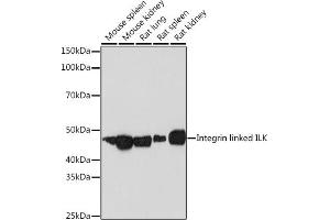 Western blot analysis of extracts of various cell lines, using Integrin linked ILK Rabbit mAb (ABIN7267933) at 1:1000 dilution. (ILK antibody)