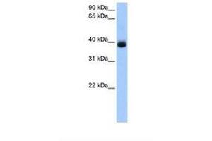 Image no. 1 for anti-serpin Peptidase Inhibitor, Clade A (Alpha-1 Antiproteinase, Antitrypsin), Member 5 (SERPINA5) (AA 269-318) antibody (ABIN6738847) (SERPINA5 antibody  (AA 269-318))