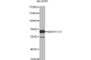 Western blot analysis of extracts of SH-SY5Y cells, using MARVELD2 antibody.