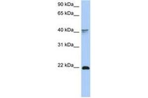 Image no. 1 for anti-Distal-Less Homeobox 4 (DLX4) (C-Term) antibody (ABIN6742745) (DLX4 antibody  (C-Term))