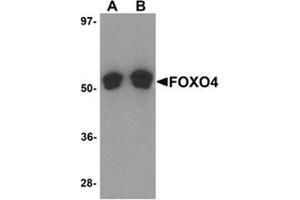 Western blot analysis of FOXO4 in A-20 cell lysate with FOXO4 antibody at (A) 0.