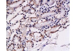 Formalin-fixed and paraffin embedded: rat kidney tissue labeled with Anti-ET-1 Polyclonal Antibody , Unconjugated at 1:200, followed by conjugation to the secondary antibody and DAB staining (Prepro-Endothelin-1 (AA 16-110) antibody)