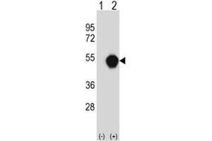 Western blot analysis of PXK antibody and 293 cell lysate (2 ug/lane) either nontransfected (Lane 1) or transiently transfected (2) with the PXK gene. (PXK antibody  (AA 221-251))