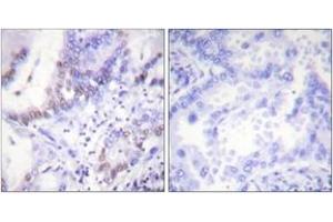 Immunohistochemistry (IHC) image for anti-C-Abl Oncogene 1, Non-Receptor tyrosine Kinase (ABL1) (AA 361-410), (pTyr393) antibody (ABIN1531252)