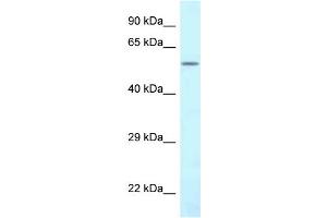 WB Suggested Anti-CTPS2 Antibody Titration: 1. (CTPS2 antibody  (N-Term))
