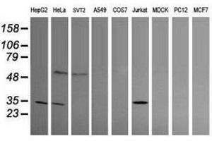Image no. 1 for anti-Proline Synthetase Co-Transcribed (PROSC) antibody (ABIN1500439) (PROSC antibody)