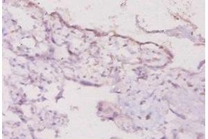 Immunohistochemistry of paraffin-embedded human placenta tissue using ABIN7177333 at dilution of 1:20 (Interferon gamma antibody  (AA 27-155))