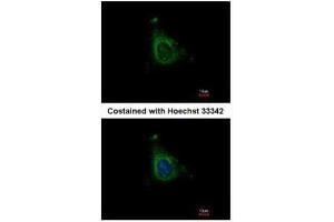 ICC/IF Image Immunofluorescence analysis of methanol-fixed HeLa, using AKAP10, antibody at 1:500 dilution. (AKAP10 antibody  (C-Term))