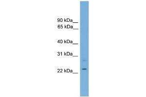WB Suggested Anti-RBM11 Antibody Titration:  0. (RBM11 antibody  (Middle Region))