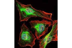 Image no. 1 for anti-BPI Fold Containing Family B, Member 1 (BPIFB1) (AA 248-475) antibody (ABIN1502165) (BPIFB1 antibody  (AA 248-475))