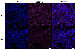 Immunocytochemical staining of HeLa cells using Sirtuin 3 antibody (ABIN7800354), 1:1,000), Top panel: wild-type (WT), Bottom panal: Sirtuin 3 shRNA knockdown (KD).