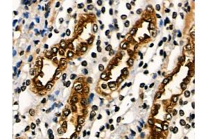 ABIN6265563 and ABIN6266644 at 1/100 staining Rat kidney tissue by IHC-P. (PAR1 antibody  (N-Term))