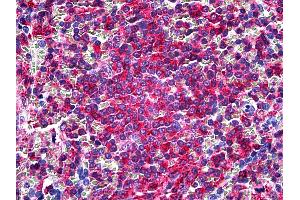 Anti-L Plastin antibody IHC of human spleen.