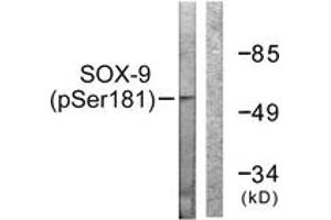 Western blot analysis of extracts from 293 cells treated with PBS 60', using SOX-9 (Phospho-Ser181) Antibody. (SOX9 antibody  (pSer181))