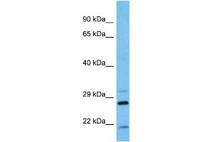 Host:  Mouse  Target Name:  KCNIP2  Sample Tissue:  Mouse Pancreas  Antibody Dilution:  1ug/ml (KCNIP2 antibody  (N-Term))