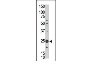 The anti-GEH1 Pab (ABIN390121 and ABIN2840628) is used in Western blot to detect GEH1 in Jurkat cell lysate. (MAGEH1 antibody  (C-Term))