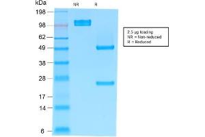 SDS-PAGE Analysis Purified IgM Mouse Recombinant Monoclonal Antibody (rIM373). (Recombinant IGHM antibody)