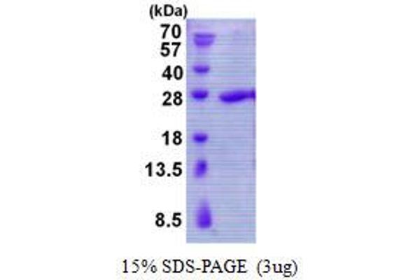 TBPL1 Protein (His tag)