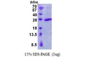 Image no. 1 for TBP-Like 1 (TBPL1) protein (His tag) (ABIN1098505)