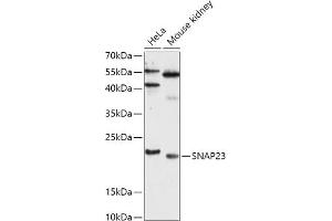 Western blot analysis of extracts of various cell lines, using SN antibody (ABIN7270670) at 1:1000 dilution. (SNAP23 antibody  (AA 1-211))