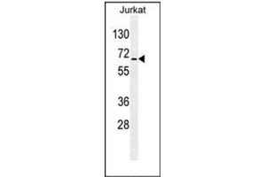 Western blot analysis of RBM14 Antibody (C-term) in Jurkat cell line lysates (35ug/lane).