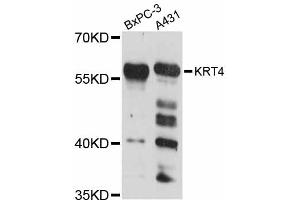 Western blot analysis of extracts of various cell lines, using KRT4 antibody (ABIN5998102) at 1:3000 dilution. (KRT4 antibody)