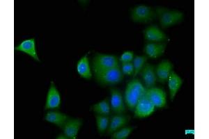 Immunofluorescence staining of Hela cells with ABIN7157186 at 1:50, counter-stained with DAPI. (KALRN antibody  (AA 2410-2661))