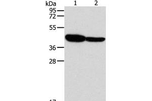 Western Blot analysis of Mouse brain and Human fetal brain tissue using GLRA1 Polyclonal Antibody at dilution of 1:500 (GLRA1 antibody)