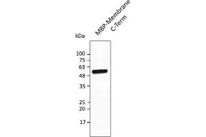 Western Blotting (WB) image for anti-SARS-CoV-2 Membrane Protein (SARS-CoV-2 M) (AA 150-215) antibody (ABIN7273018) (SARS-CoV-2 Membrane Protein antibody  (AA 150-215))