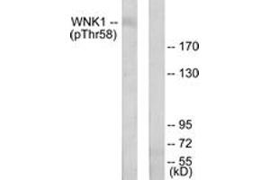 Western blot analysis of extracts from 293 cells treated with EGF 200ng/ml 30', using WNK1 (Phospho-Thr58) Antibody. (WNK1 antibody  (pThr60))