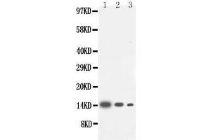 Anti-IL-4 antibody, Western blotting Lane 1: Recombinant Human IL-4 Protein 10ng Lane 2: Recombinant Human IL-4 Protein 5ng Lane 3: Recombinant Human IL-4 Protein 2.