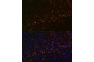 Immunofluorescence analysis of mouse brain using Huntingtin Rabbit mAb (ABIN7267793) at dilution of 1:100 (40x lens). (Huntingtin antibody)