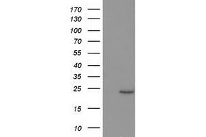 Western Blotting (WB) image for anti-Suppressor of Cytokine Signaling 3 (SOCS3) antibody (ABIN1501059) (SOCS3 antibody)