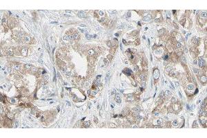 ABIN6279042 at 1/100 staining Human prostate tissue by IHC-P. (RPL24 antibody  (Internal Region))