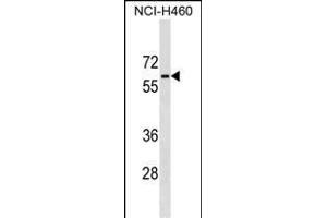PGM5 Antibody (C-term) (ABIN1537280 and ABIN2849179) western blot analysis in NCI- cell line lysates (35 μg/lane). (Phosphoglucomutase 5 antibody  (C-Term))