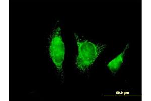 Immunofluorescence of purified MaxPab antibody to ADH1B on HeLa cell. (ADH1B antibody  (AA 1-375))
