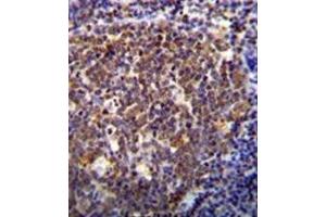 Immunohistochemistry analysis in formalin fixed and paraffin embedded human tonsil tissue reacted with HOXB6 / HOX2B Antibody (Center) followed  which was peroxidase-conjugated to the secondary antibody, followed by DAB staining. (HOXB6 antibody  (Middle Region))