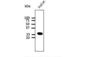 Anti-Calnexin Ab at 1/500 dilution, lysates at 50 per Iane, rabbit polyclonal to goat lµg (HRP) at 1/10,000 dilution,