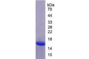 SDS-PAGE of Protein Standard from the Kit (Highly purified E. (MASP2 ELISA Kit)