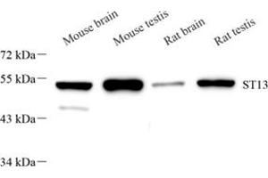 Western blot analysis of ST13 (ABIN7075761),at dilution of 1: 2000 (HSC70 Interacting Protein HIP antibody)