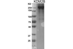 Recombinant FBXL10 / KDM2B protein gel. (KDM2B Protein (DYKDDDDK Tag))