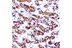 Immunohistochemistry of paraffin-embedded human liver using SERPINC1 Rabbit mAb (ABIN7270208) at dilution of 1:100 (40x lens). (SERPINC1 antibody)